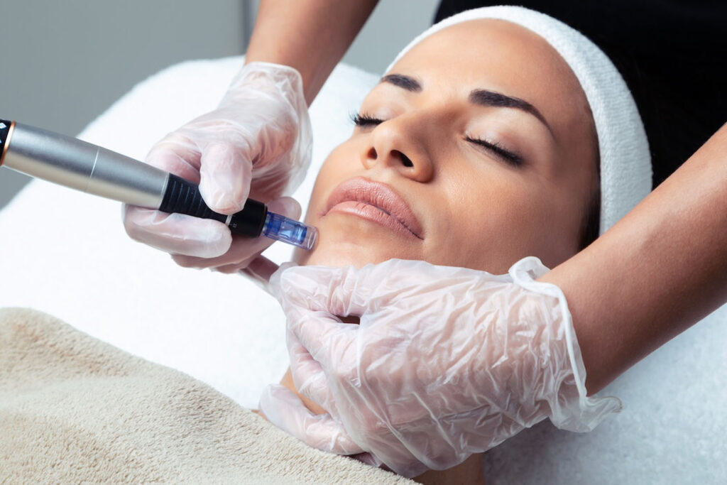 Microneedle Mesotherapy Treatment