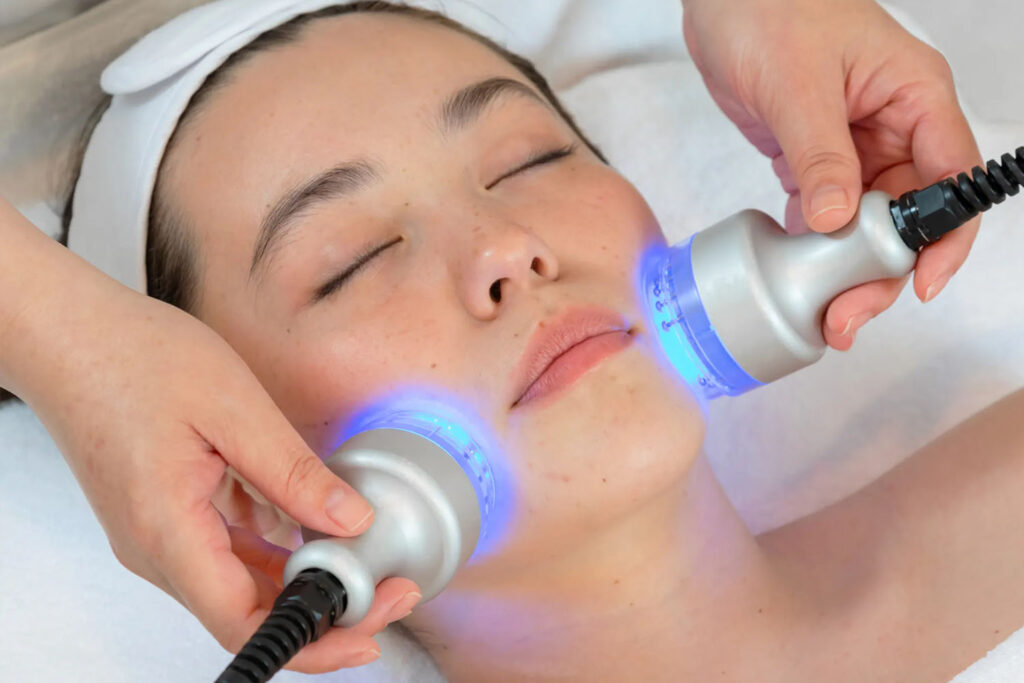 Photo Facial Treatment